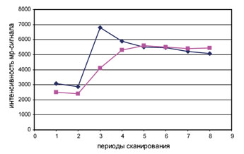 Динамика накопления МР контрастного препарата. Период сканирования 15-20 сек